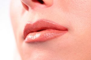 Lip Augmentation Indianapolis Dr Barry Eppley