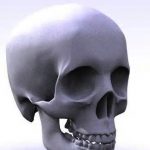 Skull Reshaping Surgery Dr Barry Eppley Indianapolis