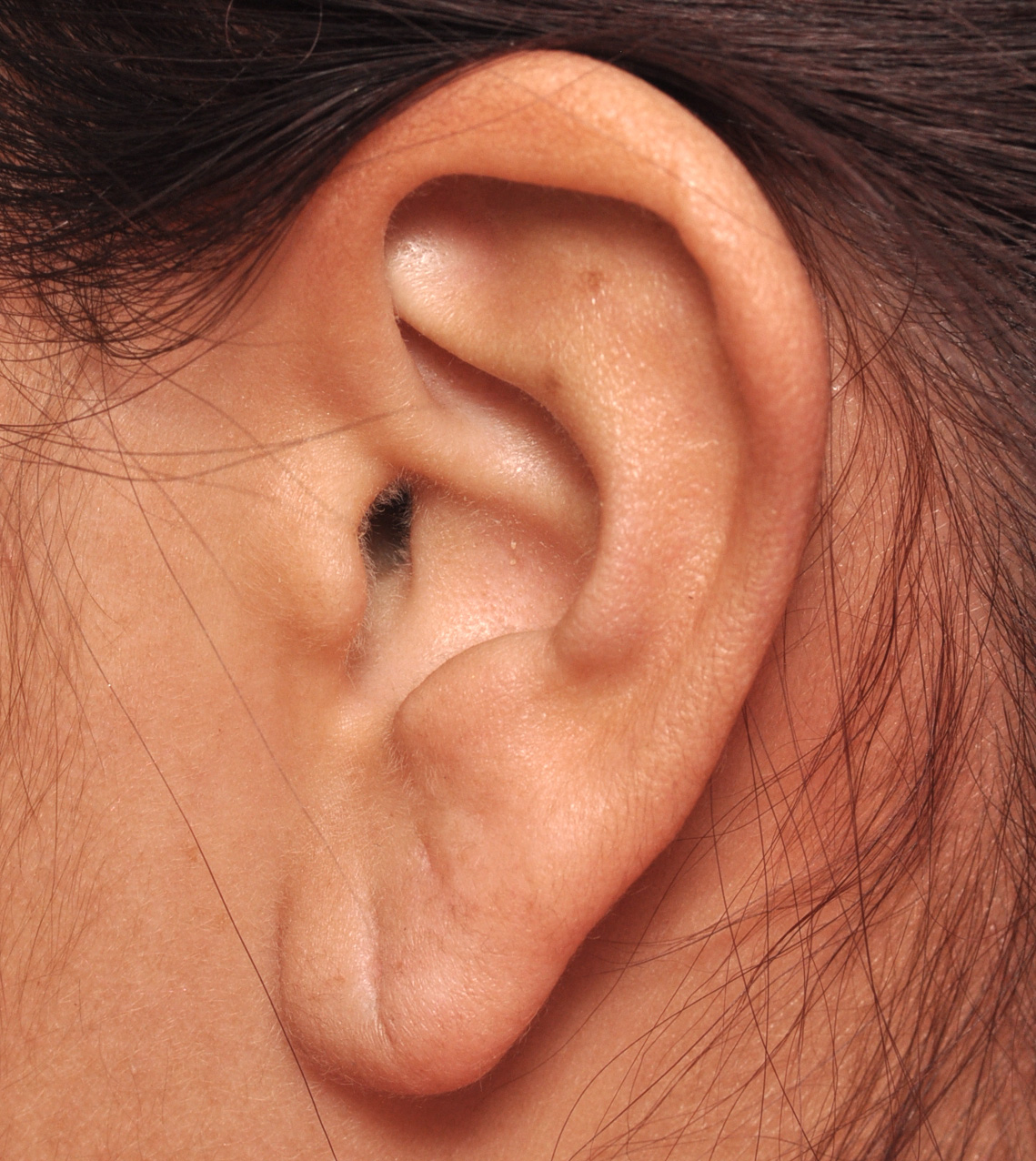 Ear Piercing  Barry Pediatrics