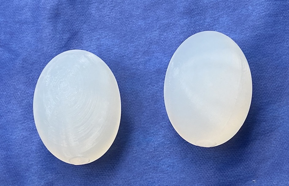 Testicle Implants Plastic Surgeon Dr. Barry L. Eppley, MD